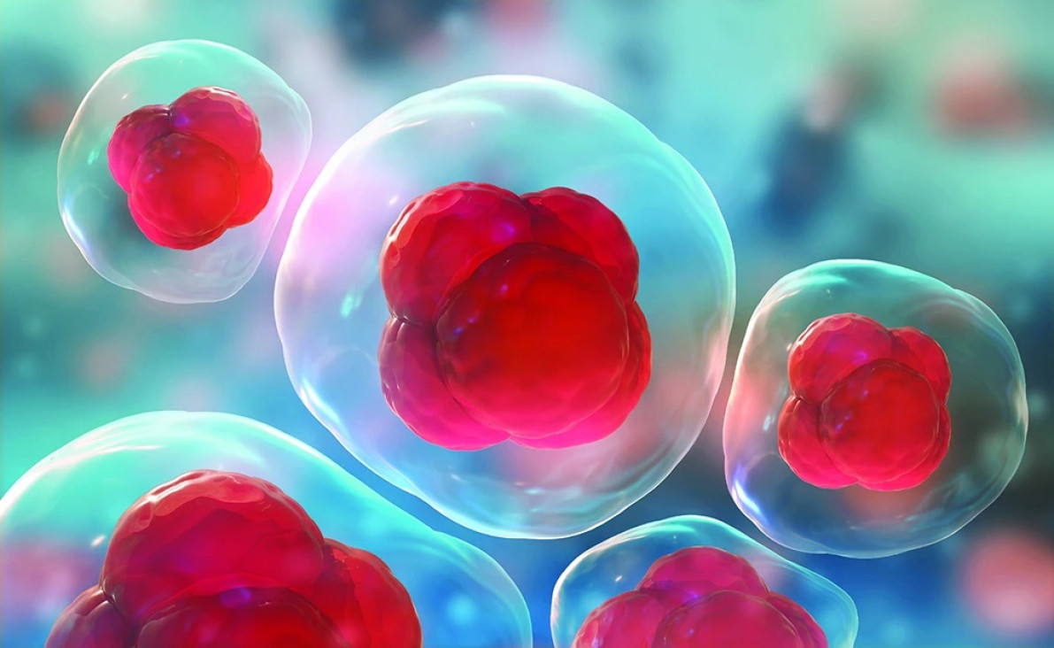 imagen Estudian la variación del número de copias de las Heat Shock Proteins en los subtipos moleculares del cáncer de mama